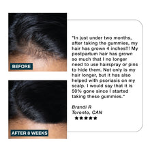 Imarais Beauty Nourish Haircare Gummies for Hair Growth, Anti-Shedding - Vegan and Sugar-Free - 60ct