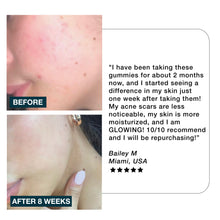 Imarais Beauty Glow Skin Care Gummies for Hydration Collagen Boosting - Vegan and Sugar-Free - 60ct